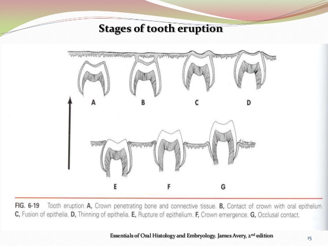 eruption-shedding-15-638